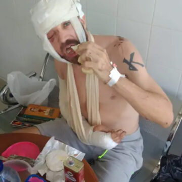 Morgan Segui Sobrevivió en la selva gracias a cabras