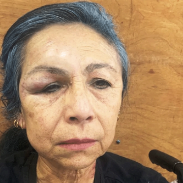 robo Enfermera es brutalmente golpeada durante asalto en Luque