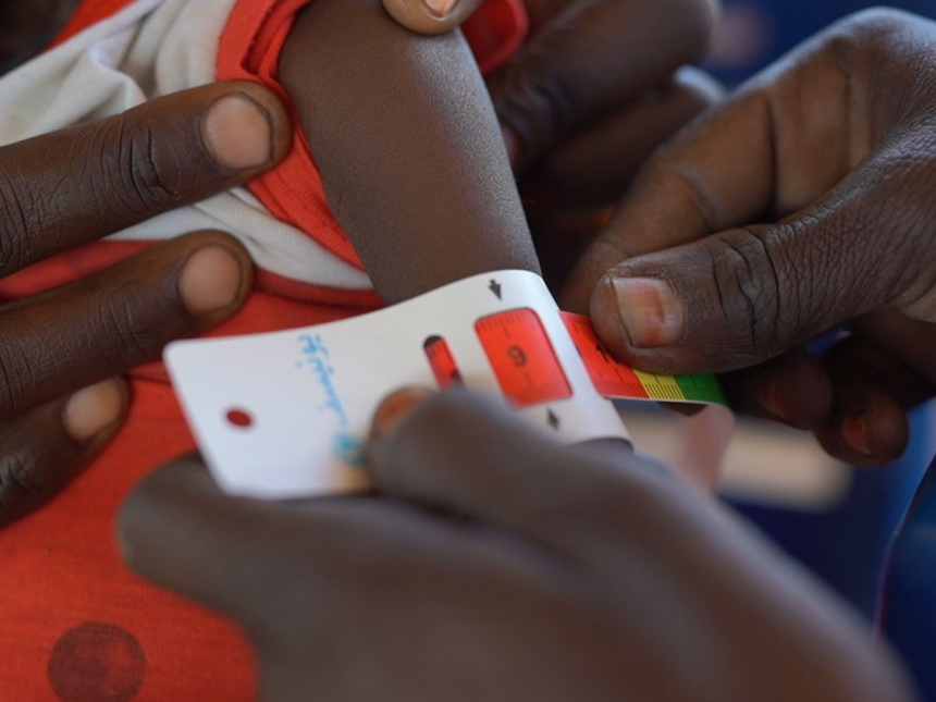 zunicef UNICEF alerta por desnutrición infantil extrema